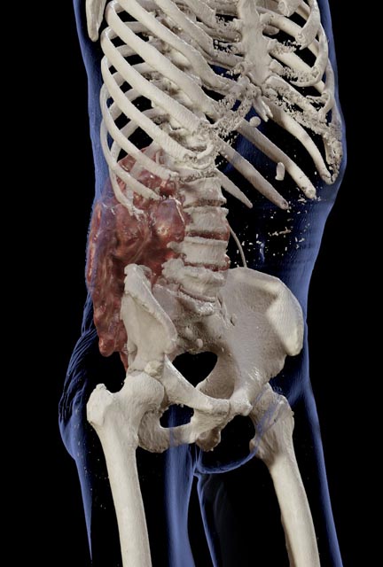 Die Vorbereitung der Operation erfolgte unter anderem mit Hilfe eines detailgetreuen 3D-Modells in Virtual Reality. Fotos: zVg